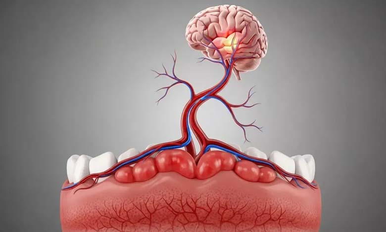 Gum Diseases: A Risk Factor for White Matter Damage in the Brain