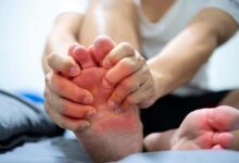 How Daily Hydration Reduces the Risk of Gout