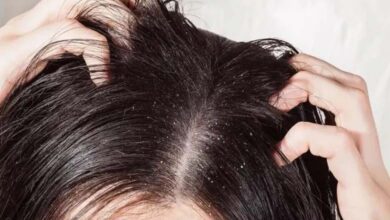How does zinc help fight dandruff?