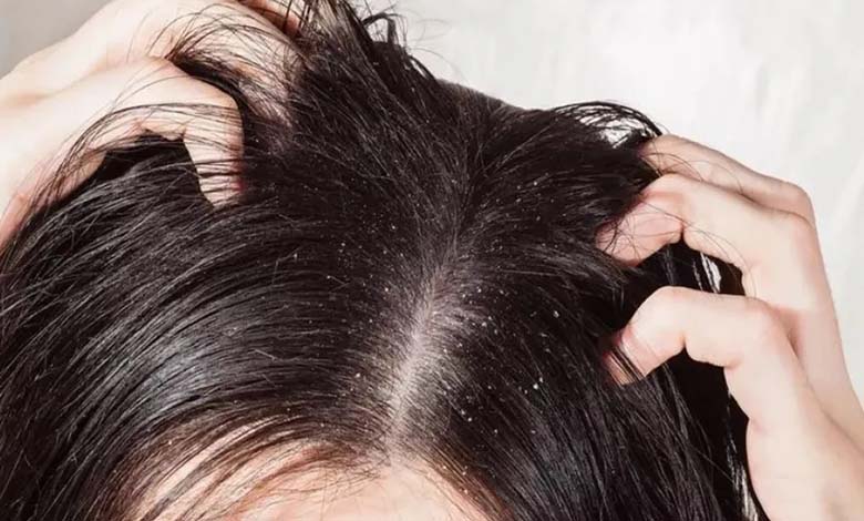 How does zinc help fight dandruff?