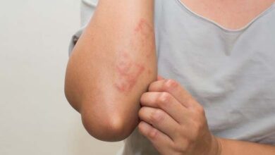 Itchy skin: an early warning sign of kidney disease