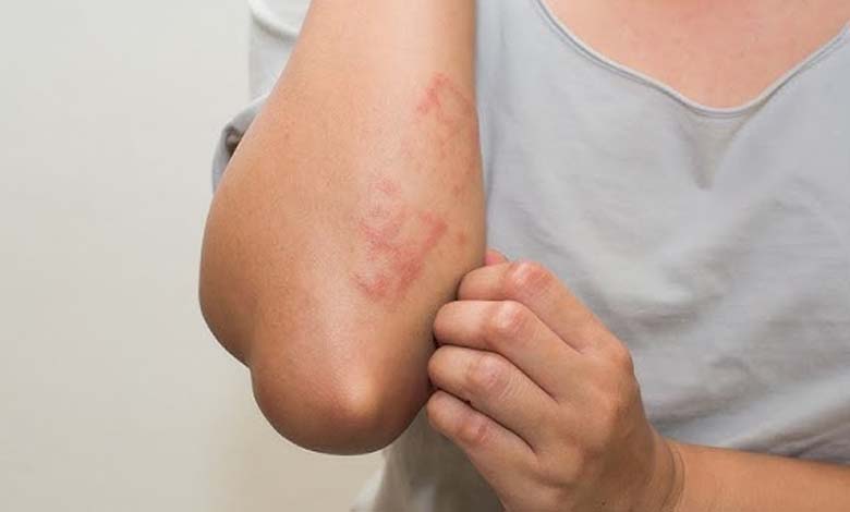 Itchy skin: an early warning sign of kidney disease