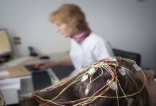 A new epilepsy treatment: removing senescent brain cells as a therapeutic pathway