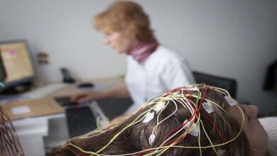 A new epilepsy treatment: removing senescent brain cells as a therapeutic pathway