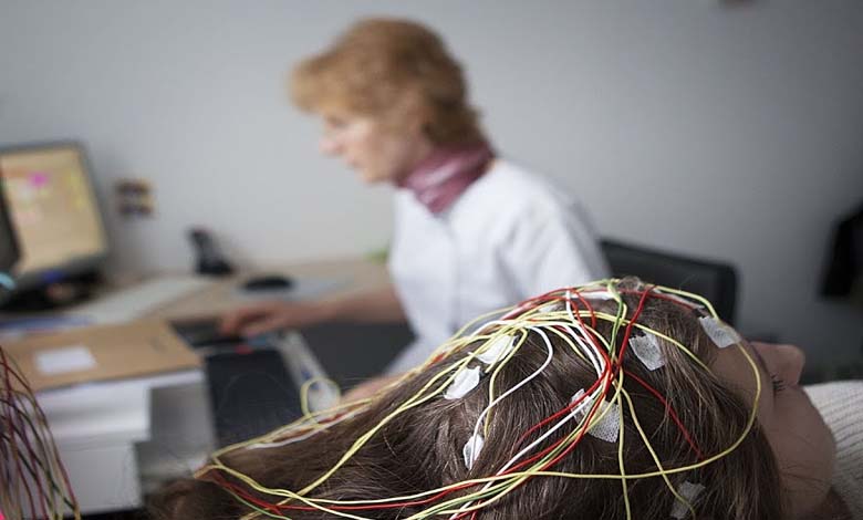 A new epilepsy treatment: removing senescent brain cells as a therapeutic pathway