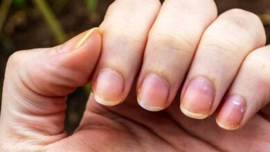 Pale lips and brittle nails: visible signs that may reveal a hidden health issue