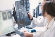 Scientific study: a potential link between Alzheimer’s disease and a bacterial infection originating in the gums