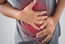 How stress affects gut health : A complex relationship between the mind and the digestive system