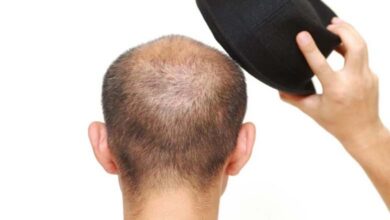 Do Hats Cause Hair Loss? Experts Clarify the Truth