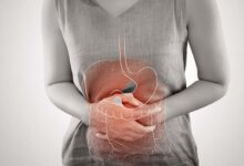 Early signs of gut problems you should never ignore