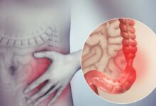 How often should a healthy person have a bowel movement?