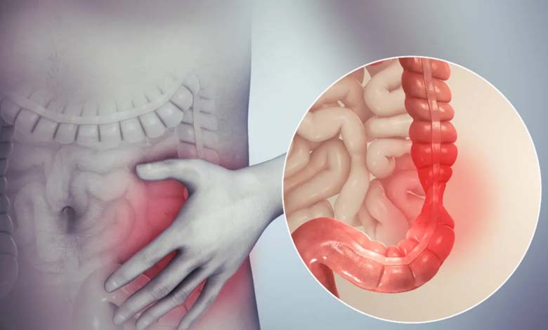 How often should a healthy person have a bowel movement?