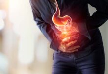 How to Avoid Bloating and Indigestion During Ramadan