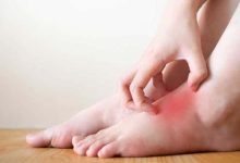 Concerning warning signs that may begin with simple itching in the feet: understanding causes and implications