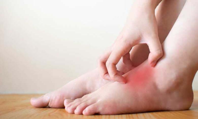 Concerning warning signs that may begin with simple itching in the feet: understanding causes and implications
