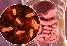 How do gut bacteria influence cravings for sugar and fat? A scientific analysis of the microbiome and its interaction with the brain