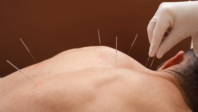 Acupuncture as a safer alternative: its role in addressing the opioid crisis