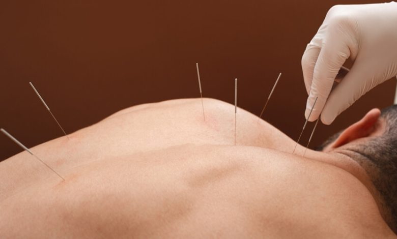 Acupuncture as a safer alternative: its role in addressing the opioid crisis