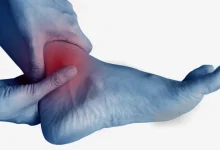 Swelling of the Extremities in Hot Weather: Warning Signs That Should Never Be Ignored