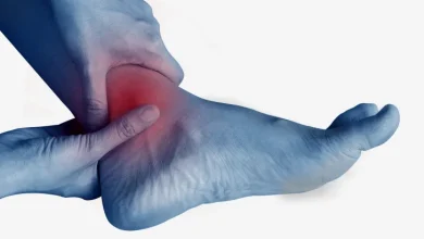 Swelling of the Extremities in Hot Weather: Warning Signs That Should Never Be Ignored