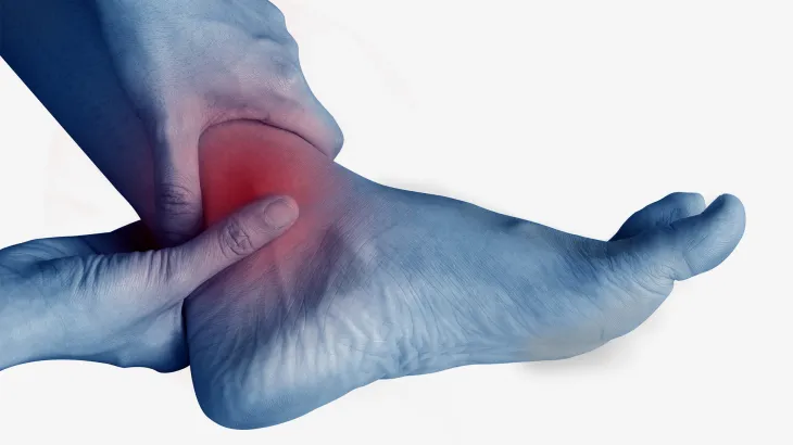 Swelling of the Extremities in Hot Weather: Warning Signs That Should Never Be Ignored