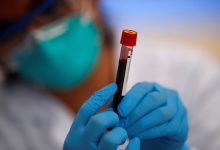 Without a blood test: how to recognize possible signs of iron deficiency
