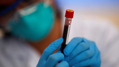 Without a blood test: how to recognize possible signs of iron deficiency