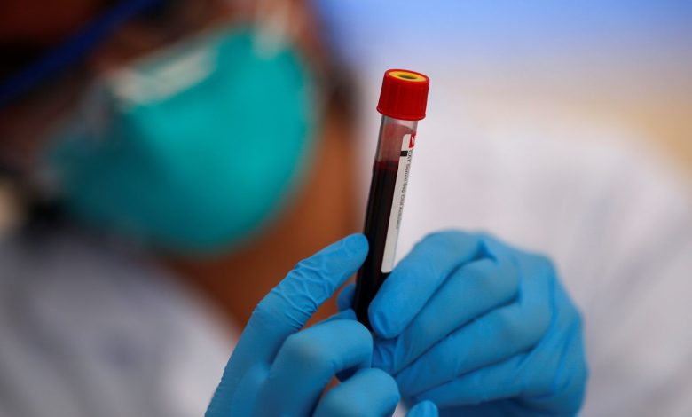 Without a blood test: how to recognize possible signs of iron deficiency