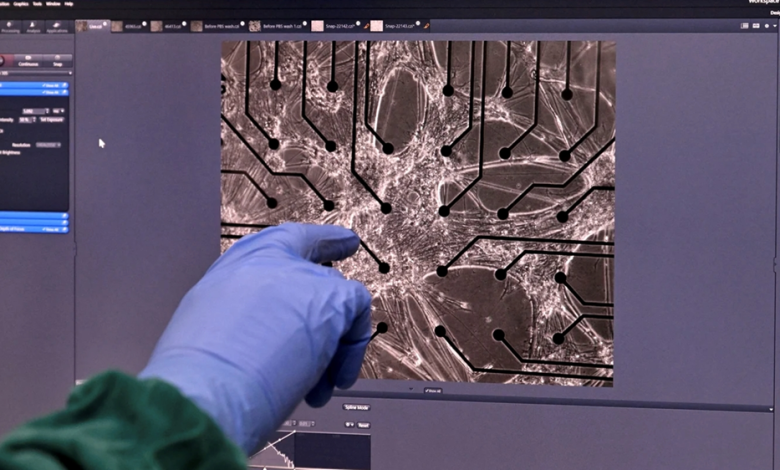 Brain cells on a chip learn to fight in a video game!