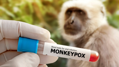 Pakistan confirms a new monkeypox case in Karachi amid renewed public health vigilance