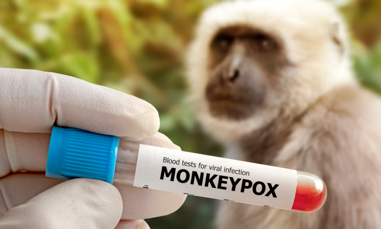 Pakistan confirms a new monkeypox case in Karachi amid renewed public health vigilance