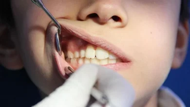 Intermittent Fasting May Help Treat Gum Disease