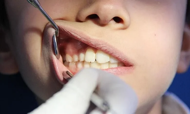 Intermittent Fasting May Help Treat Gum Disease