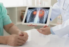 Study Suggests Belly Fat May Increase the Risk of Lung Cancer