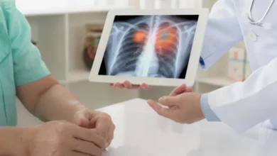 Study Suggests Belly Fat May Increase the Risk of Lung Cancer