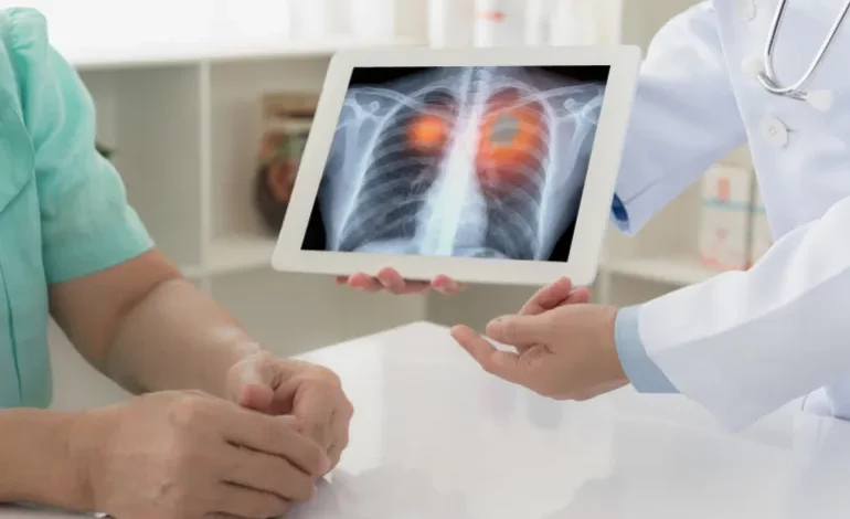 Study Suggests Belly Fat May Increase the Risk of Lung Cancer
