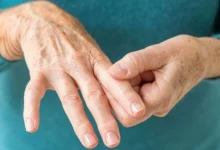 What Is the Link Between Rheumatoid Arthritis and Heart Disease?