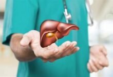 Hesperetin: A Citrus Compound That May Help Slow Liver Aging
