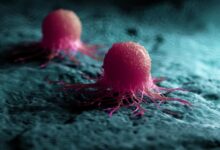 How Could Fructose Contribute to Cancer Tumor Recurrence?