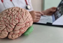 Dementia: How Blood Vessel Health Influences Brain Function
