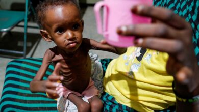Starvation as a Weapon in Detention Centres: Emaciated Bodies as Evidence of a Silent Extermination