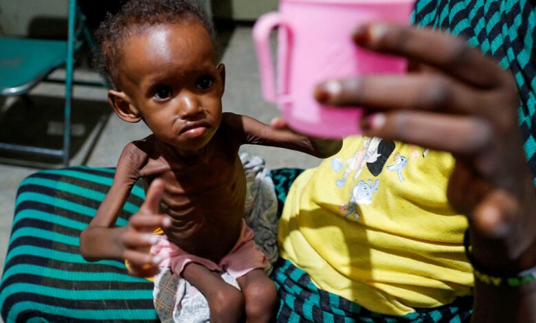 Starvation as a Weapon in Detention Centres: Emaciated Bodies as Evidence of a Silent Extermination